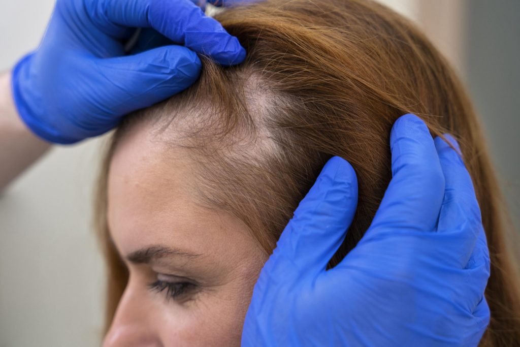 Woman getting hair loss treatment clinic