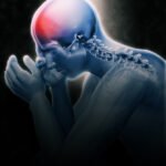 Understanding Multiple Sclerosis (MS)