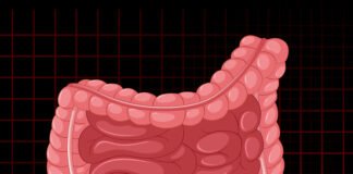 Inflammatory Bowel Disease (IBD)