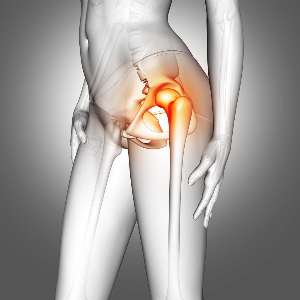3d female medical figure with hip bone highlighted