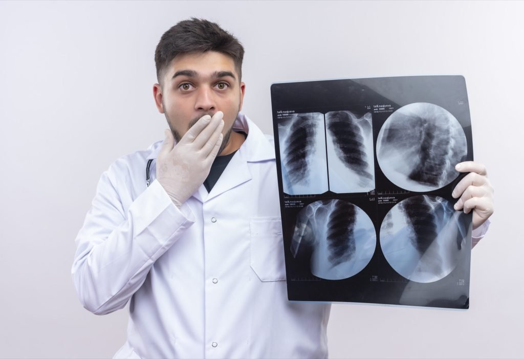 Young handsome doctor wearing white medical gown white medical gloves stethoscope scared holding tomography standing white...
