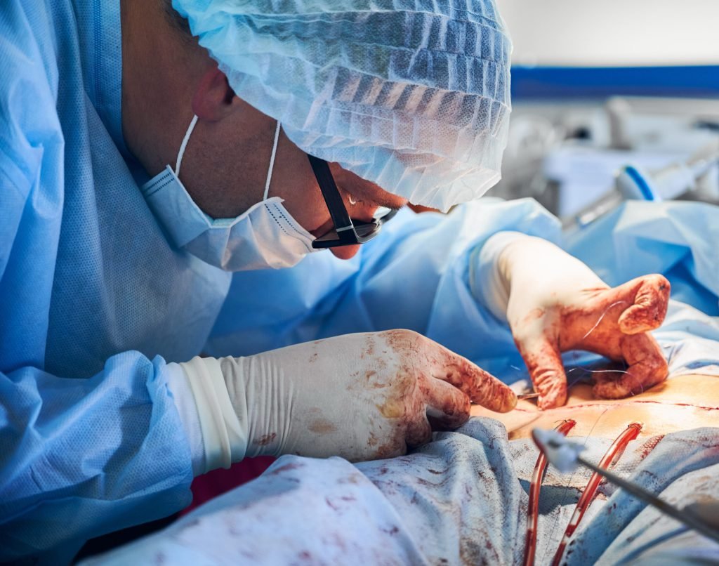 Male doctor placing sutures following abdominoplasty procedure