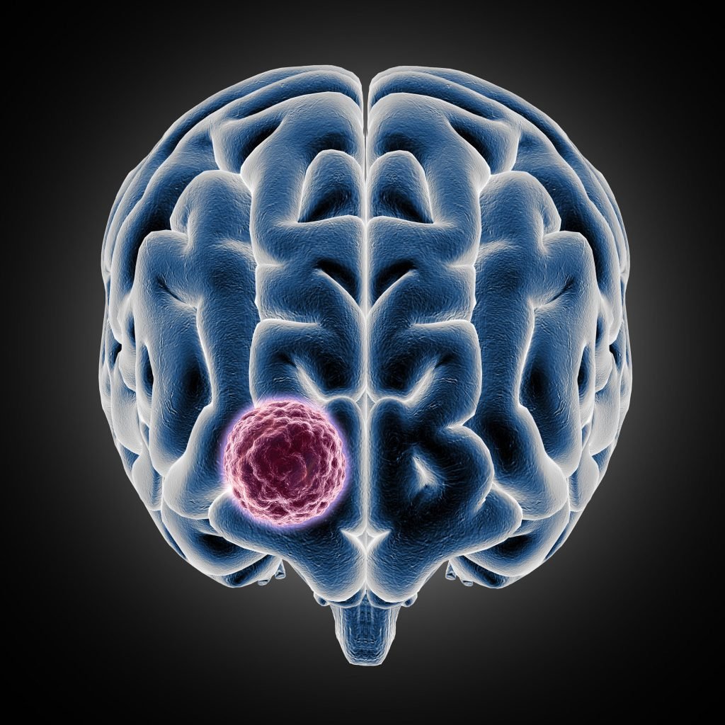Thyroid Problems & Diseases