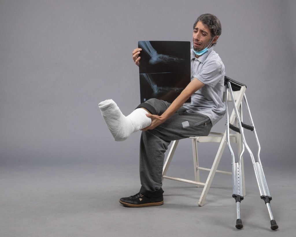 Front view young male sitting with broken foot holding x ray it grey desk pain leg broken male accident foot twist