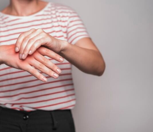 Natural Ways to Reduce Uric Acid in the Body; Its Symptoms and Causes