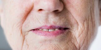 The Best Wrinkle Treatment Procedures to Diminish Wrinkles