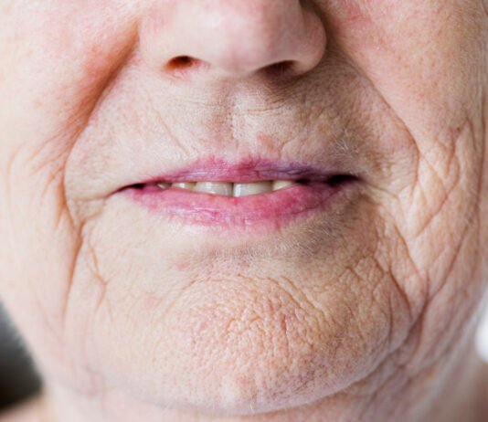 The Best Wrinkle Treatment Procedures to Diminish Wrinkles