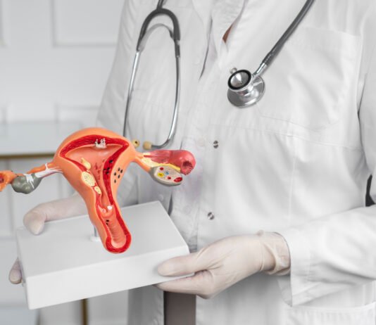 Cervical Cancer: Causes, Symptoms, Diagnosis and Treatment