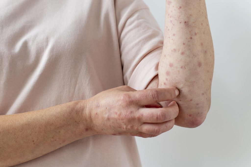 Skin allergy person s arm