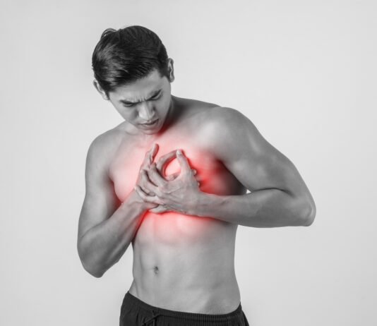 Cardiac Arrest: Causes, Symptoms, and Prevention