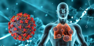 What Is Chronic Obstructive Pulmonary Disease (COPD)?