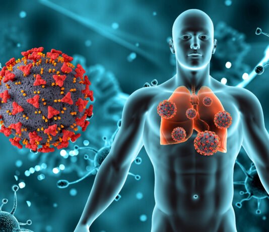 What Is Chronic Obstructive Pulmonary Disease (COPD)?