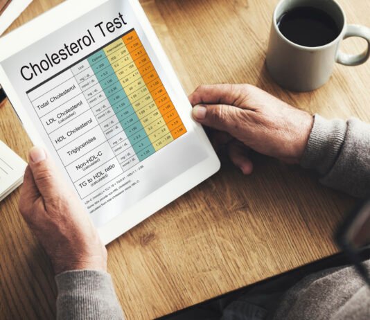 Does Exercise Lower Cholesterol? Best Exercises to Control Cholesterol