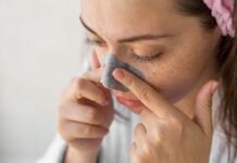 What are Deep Blackheads? How to Get Rid of Them Professionally or at Home?