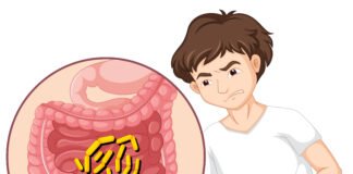 Listeria Infection (Listeriosis): What to Know