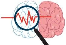Understanding Cognitive Decline: How Your Brain Changes as You Age