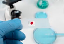 What to Know About T-Cell Leukemia