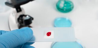 What to Know About T-Cell Leukemia