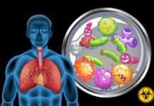 What Is Amyloidosis and How Is It Treated?