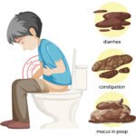 Anxiety Poop: Why It Happens and How to Treat