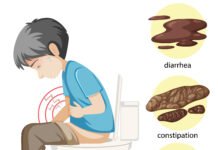 Anxiety Poop: Why It Happens and How to Treat