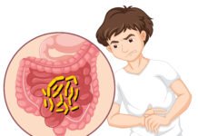 Everything You Need to Know about Angioedema and How to Reduce Angioedema Swelling?