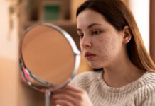 What is Acne Vulgaris (Hormonal Acne)? The Best Diet and Supplements for Prevention and Treatment
