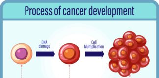 Everything You Need to Know about Dysplasia
