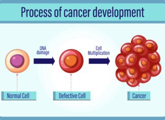 Everything You Need to Know about Dysplasia
