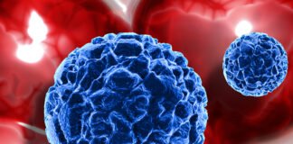 What Is Plasmacytoma?