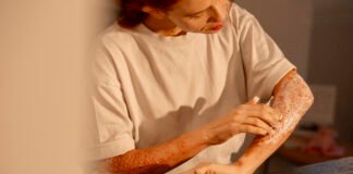 Type 2 Diabetes and Skin Health