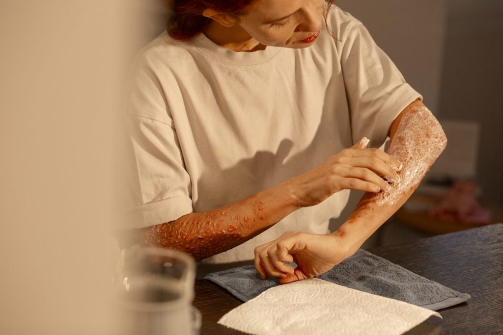 Front view woman experiencing skin disease