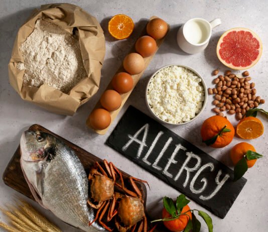 The 9 Most Common Food Allergies
