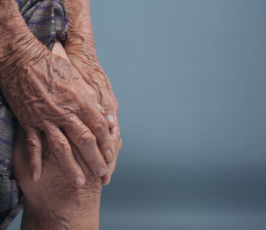 What is Ankylosing Spondylitis and the Things That May Make it Worse
