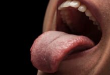 Tongue Problems, Causes, Symptoms and Care