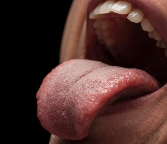 Tongue Problems, Causes, Symptoms and Care