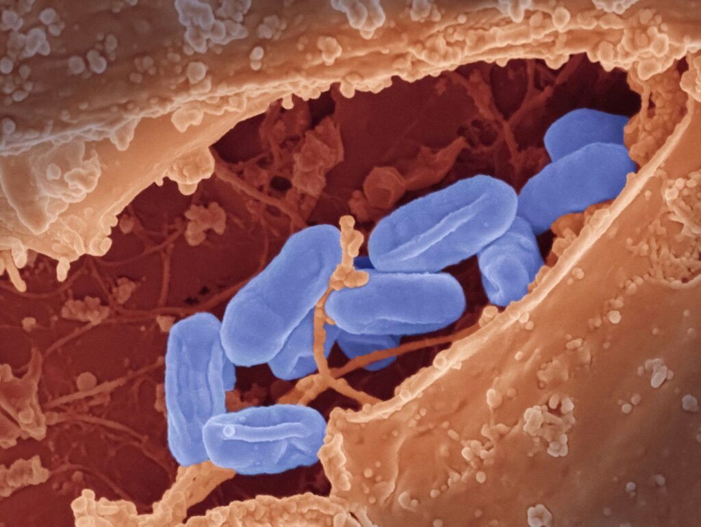 Crohn's Disease