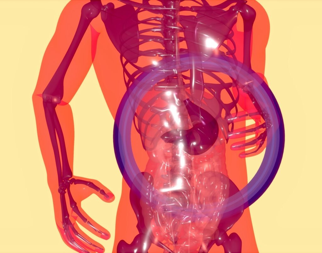 Bowel Obstruction
